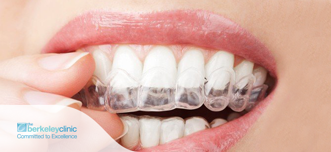 Straighten-Your-Teeth-in-6-Weeks