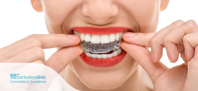 Orthodontic treatment with clear braces