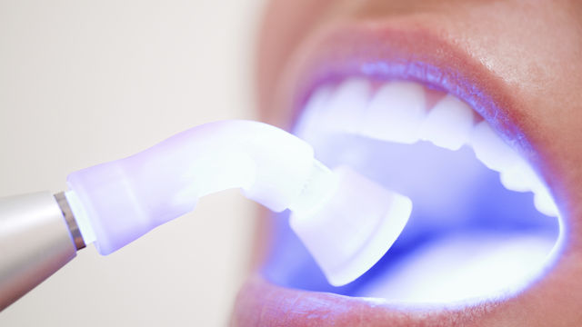 whitening-2