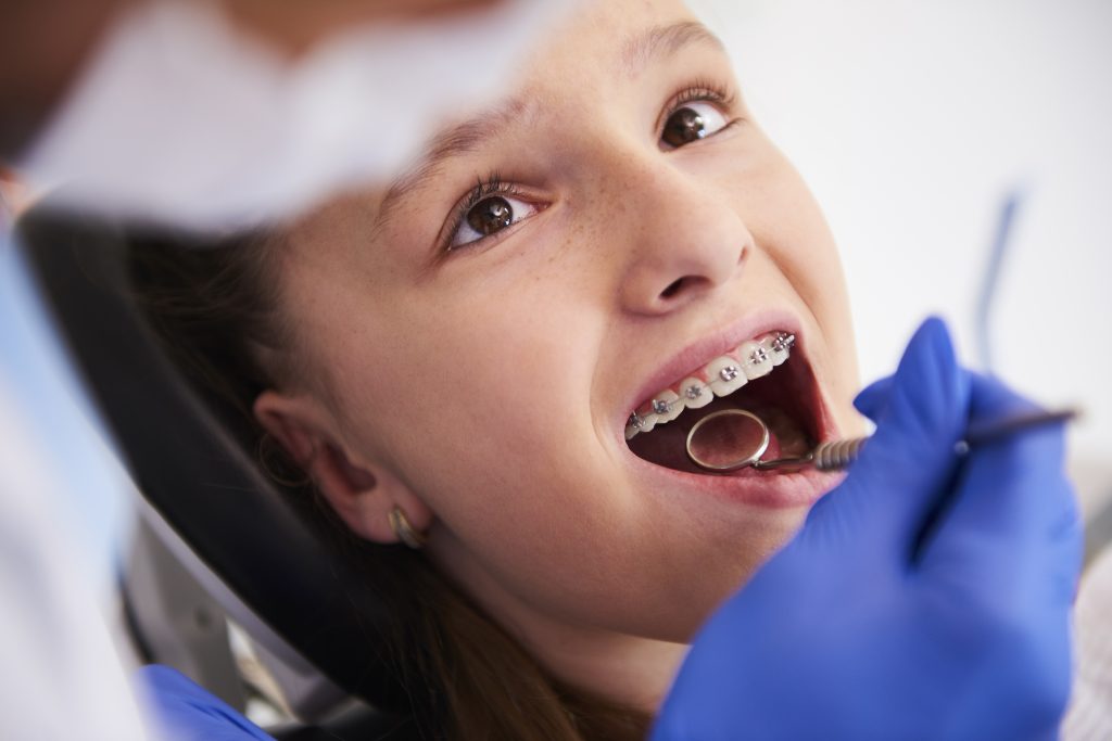 dental check up of a girl wearing adult braces